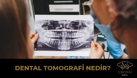 Dental Tomografi Nedir?